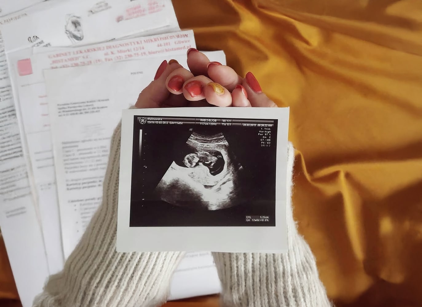 Zdjęcie USG trzymane w dłoniach, w tle dokumenty medyczne. Symbol drogi do macierzyństwa